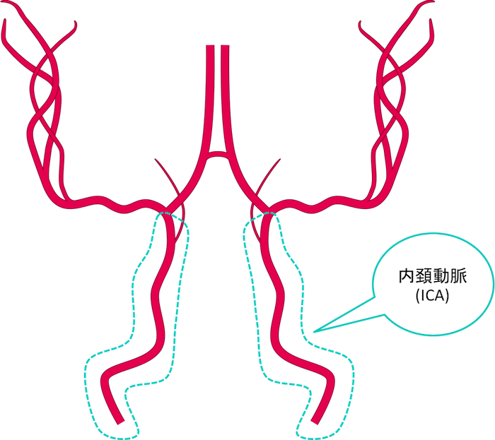 動画解説】脳血管(動脈)の解剖を図と画像でわかりやすく！